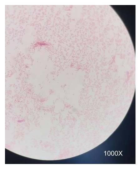 Gram Negative Stain